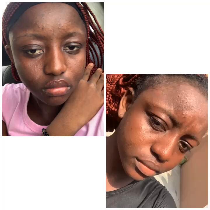 Face Shirley