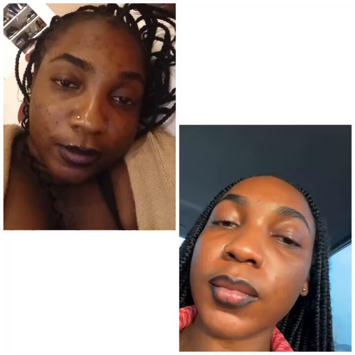 Face Shirley